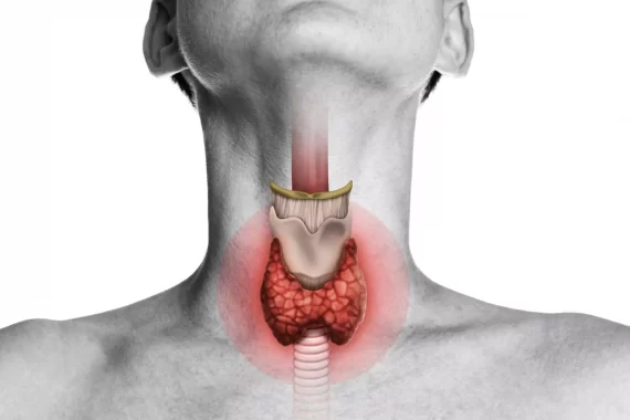 Cắt bỏ tuyến giáp có ảnh hưởng gì không? Những điều nên nhớ
