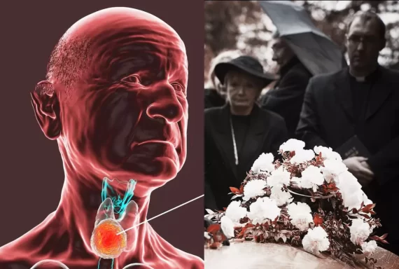 Bị K tuyến giáp có kiêng đám ma không? Cách bảo vệ sức khoẻ