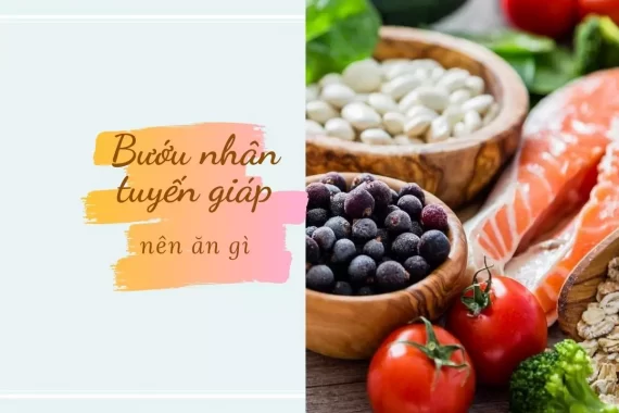 Nhân tuyến giáp nên ăn gì để cải thiện tình trạng bệnh?