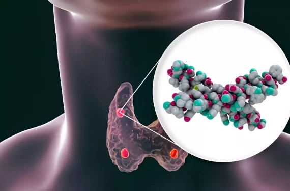 U tuyến giáp đa nhân: Nguyên nhân, biểu hiện và cách điều trị