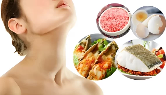 U tuyến giáp kiêng ăn gì? U tuyến giáp nên ăn gì để cải thiện bệnh