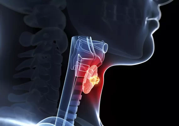 U tuyến giáp lành tính là gì? Dấu hiệu và cách điều trị hiệu quả