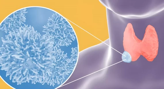 U tuyến giáp thể nhú là gì? Tất cả những điều bạn cần phải biết