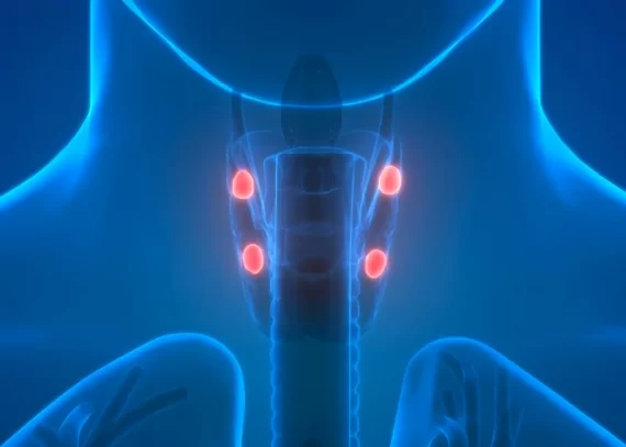 Bệnh u tuyến cận giáp là gì? Có giống u tuyến giáp không?