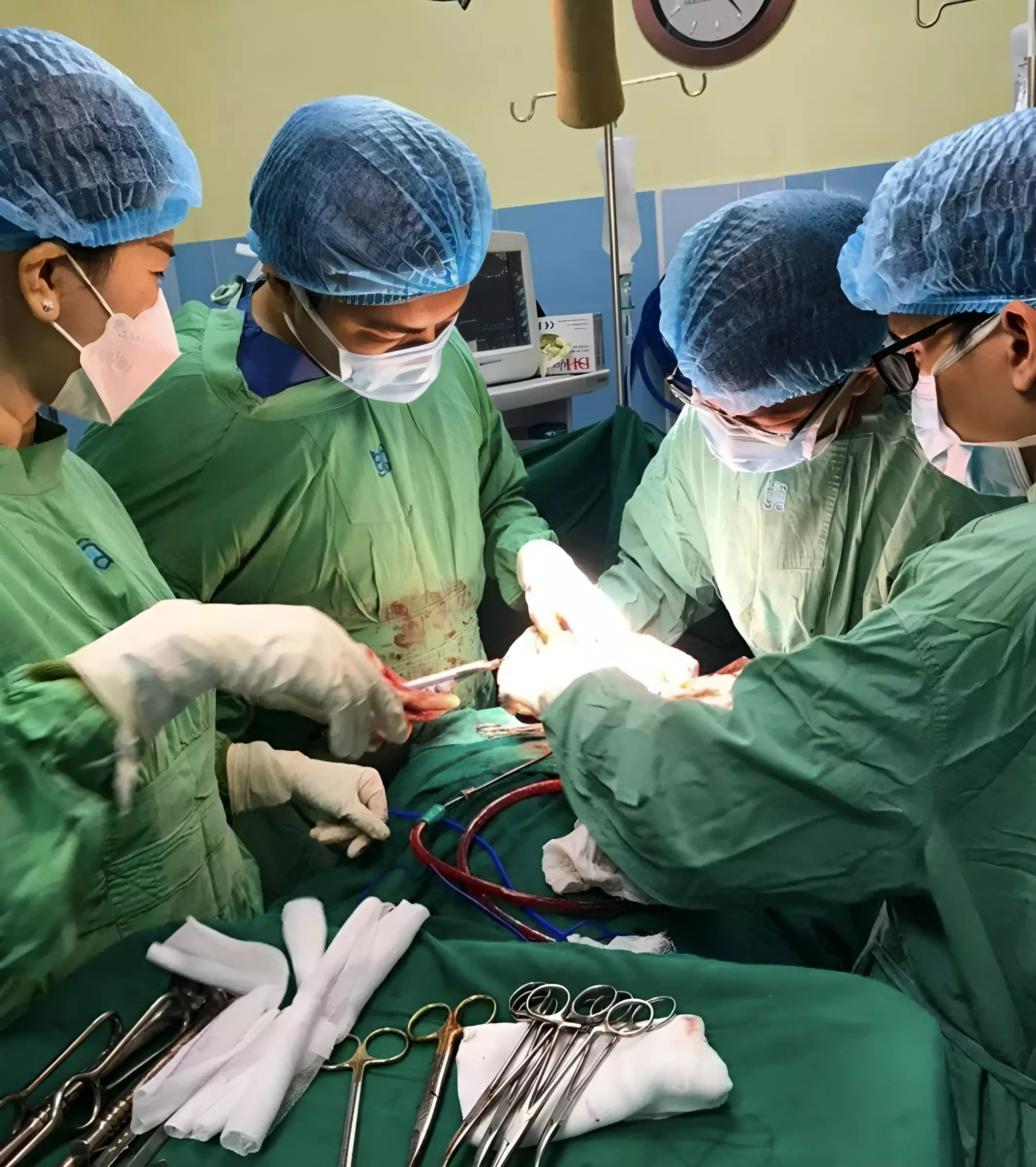 phẫu thuật u tuyến giáp tại bệnh viện đại học y dược tphcm