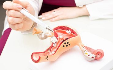 Gói khám và tầm soát ung thư phụ khoa