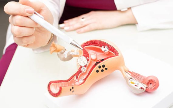 Gói khám và tầm soát ung thư phụ khoa