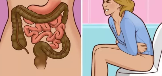 Nguyên nhân bệnh trĩ và cách phòng ngừa bệnh 99% hiệu quả