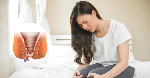 Vì sao sản phụ hay bị trĩ sau sinh thường? Cách điều trị