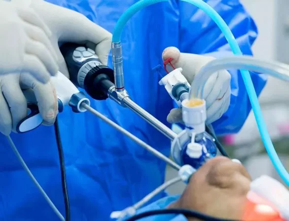 Quy Trình Mổ U Tuyến Giáp: Từ Chuẩn Bị Đến Hồi Phục