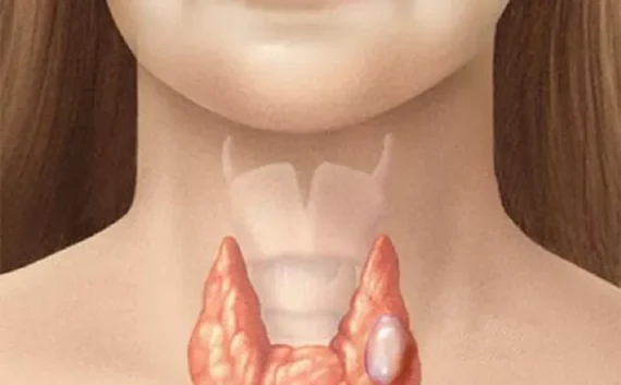 Giải đáp: Bướu nhân thùy phải tuyến giáp có nguy hiểm không?