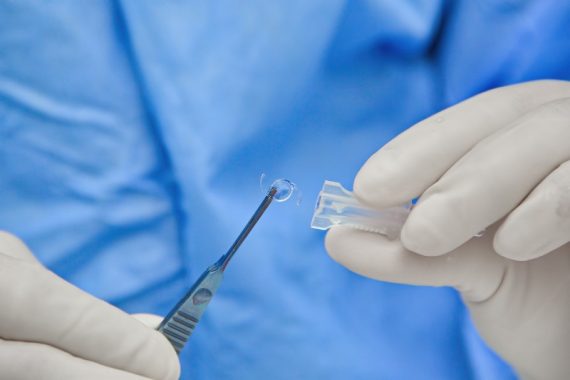 Các loại thủy tinh thể nhân tạo – Loại nào tốt nhất khi phẫu thuật Phaco?