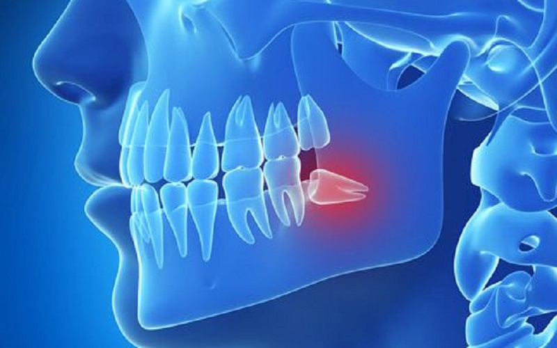 Đau quai hàm gần tai: Khi nào cần đến gặp bác sĩ?