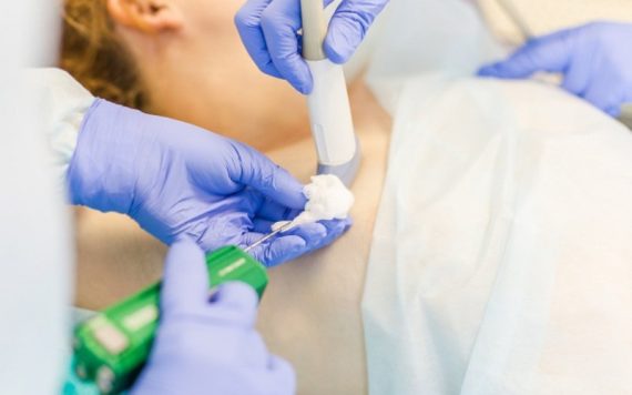 Xét nghiệm FNA và VABB: “Bộ đôi” chẩn đoán và hỗ trợ điều trị u vú hiệu quả