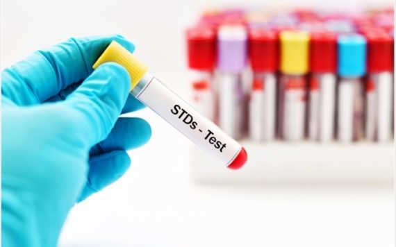 Xét nghiệm STD là gì? Bao gồm những loại nào? Tất cả sẽ được Loukas giải đáp tại đây!