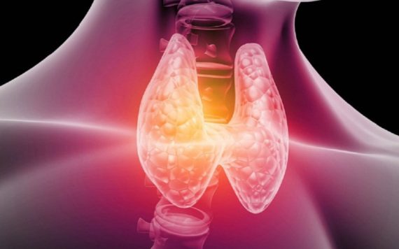 U nang tuyến giáp là gì? Đốt sóng cao tần RFA có điều trị được căn bệnh này?