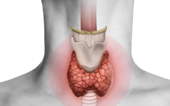 Bướu giáp lan tỏa: Triệu chứng, phân loại và phương pháp điều trị