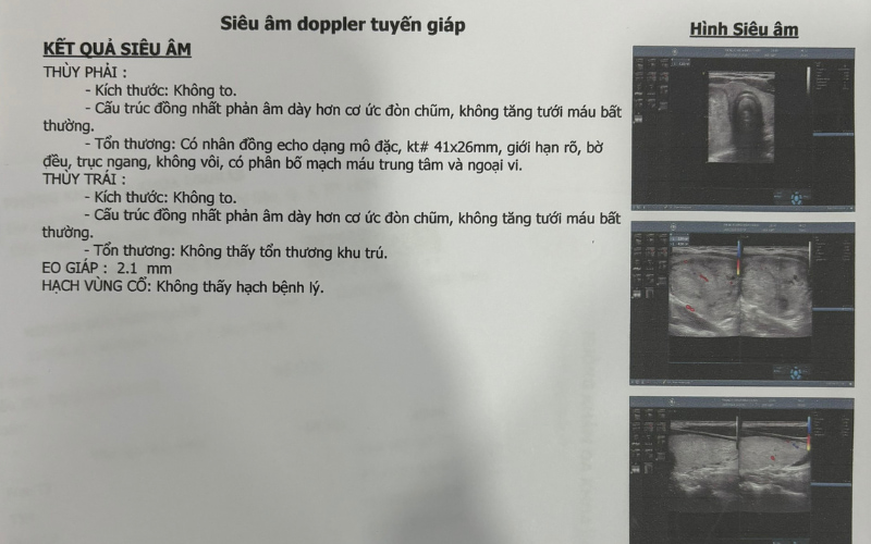 Bướu giáp nhân thùy phải không đáng sợ như bạn nghĩ: Hành trình tìm lại niềm tin của anh Quân