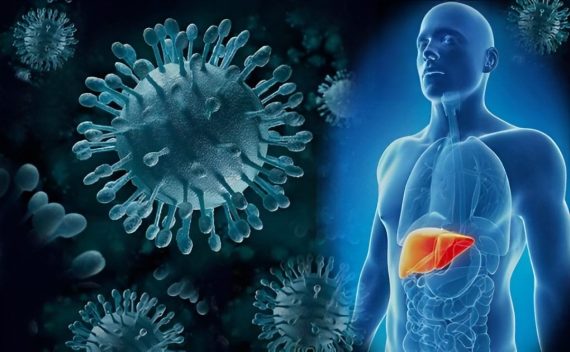 Viêm gan C có chữa khỏi được không? Và chữa bằng phương pháp nào?